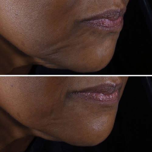 Smart Clinical Repair™ 3