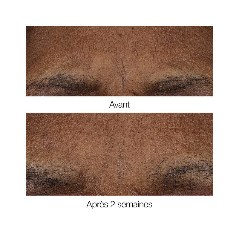 Smart Clinical Repair™ 3
