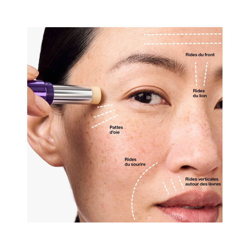 Smart Clinical Repair™ 4