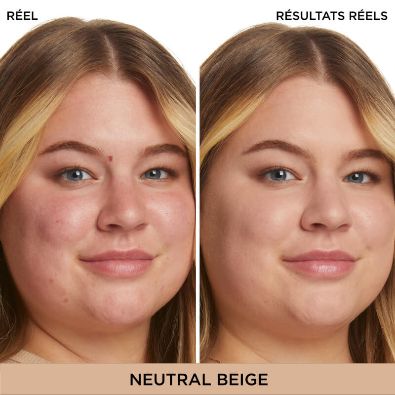 Bye Bye Redness™ 3