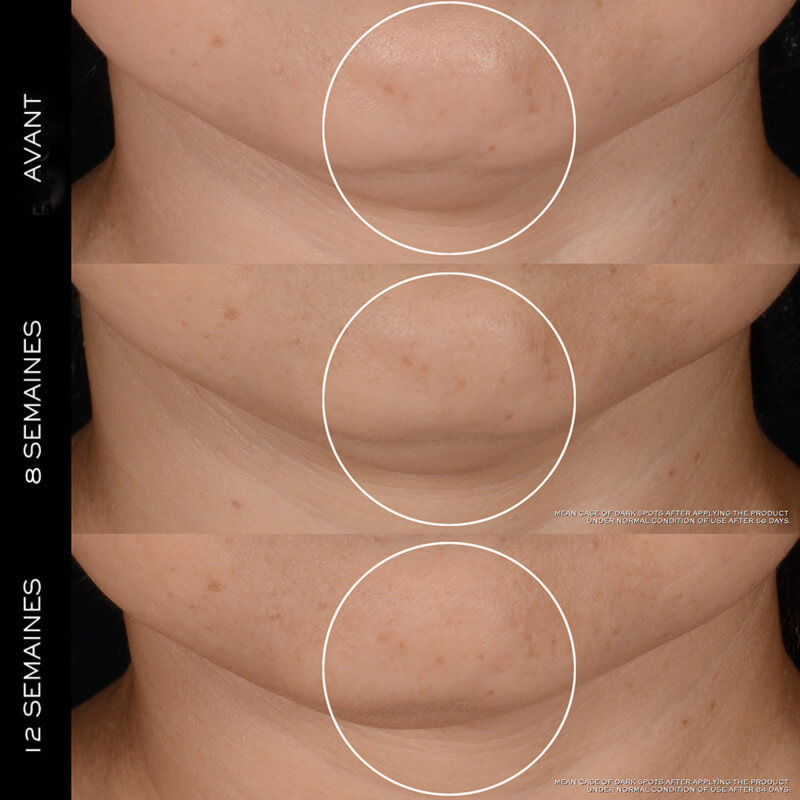 Rénergie H.P.N. 300-Peptide Crème Anti-âge Haute-Performance Rechargeable 3